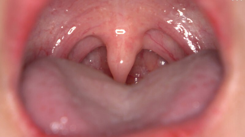 【無料体験】 「【歯・口腔フェチ】新人女優相楽さゆなちゃんの口内観察＆巨大女フェチ」わかしラボWAKA-078 相楽さゆな 9
