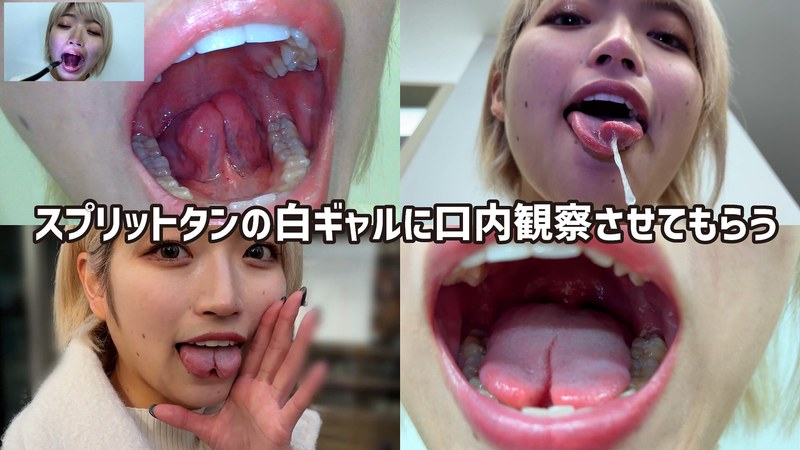 【無料体験】 街角で声をかけて口内観察させてもらう 美容部員 はるのちゃん